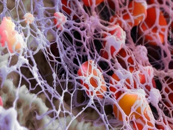 粘胶纤维是粘胶还是纤维